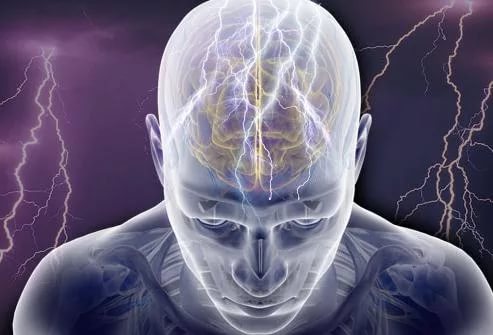 Эпилептическая деменция Эпилептическая деменция